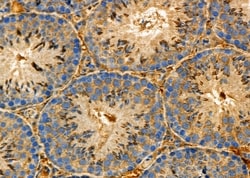 Invitrogen NG2 Polyclonal Antibody 100 &mu;L | Buy Online | Invitrogen&trade; | Fisher Scientific