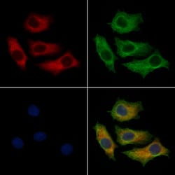Invitrogen CTPS2 Polyclonal Antibody 100 &mu;L; Unconjugated:Antibodies,