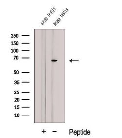 Invitrogen CTPS2 Polyclonal Antibody 100 &mu;L; Unconjugated:Antibodies,