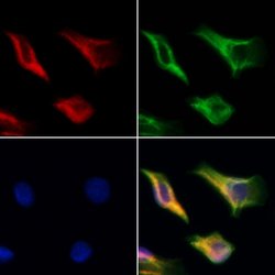 Invitrogen DARS2 Polyclonal Antibody 100 &mu;L; Unconjugated:Antibodies,