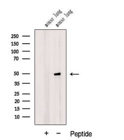 DMKN Polyclonal Antibody, Invitrogen 100 &mu;L; Unconjugated:Antibodies,