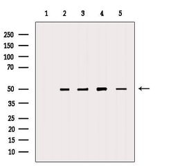 DMKN Polyclonal Antibody, Invitrogen 100 &mu;L; Unconjugated:Antibodies,