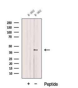 Invitrogen DUSP11 Polyclonal Antibody 100 &mu;L | Buy Online | Invitrogen&trade; | Fisher Scientific