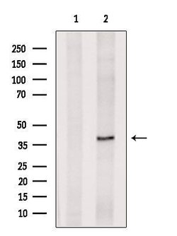 Invitrogen DUSP11 Polyclonal Antibody 100 &mu;L | Buy Online | Invitrogen&trade; | Fisher Scientific