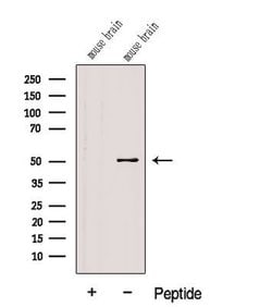 Invitrogen FADS1 Polyclonal Antibody 100 &mu;L; Unconjugated:Antibodies,