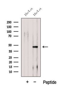 Invitrogen Folliculin Polyclonal Antibody 100 &mu;L; Unconjugated:Antibodies,