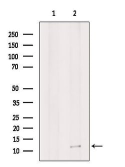 Invitrogen G0S2 Polyclonal Antibody 100 &mu;L; Unconjugated:Antibodies,