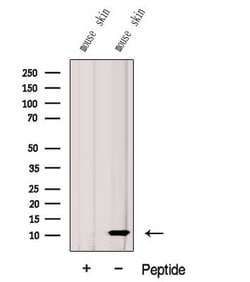 Invitrogen G0S2 Polyclonal Antibody 100 &mu;L; Unconjugated:Antibodies,