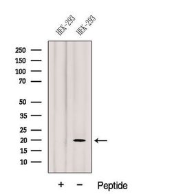 Invitrogen Gemin 6 Polyclonal Antibody 100 &mu;L; Unconjugated:Antibodies,