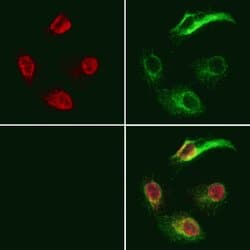 Invitrogen GNAQ Polyclonal Antibody 100 &mu;L; Unconjugated:Antibodies,