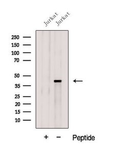 Invitrogen GNAQ Polyclonal Antibody 100 &mu;L; Unconjugated:Antibodies,