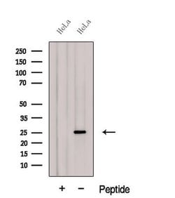 Invitrogen GSTA2 Polyclonal Antibody 100 &mu;L; Unconjugated:Antibodies,