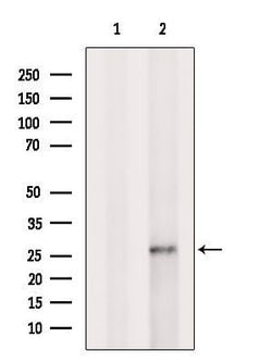 Invitrogen GSTA2 Polyclonal Antibody 100 &mu;L; Unconjugated:Antibodies,