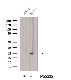 Invitrogen GSTA3 Polyclonal Antibody 100 &mu;L | Buy Online | Invitrogen&trade; | Fisher Scientific