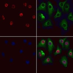 Invitrogen GSTO2 Polyclonal Antibody 100 &mu;L; Unconjugated:Antibodies,