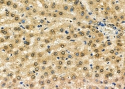 Invitrogen GSTO2 Polyclonal Antibody 100 &mu;L; Unconjugated:Antibodies,
