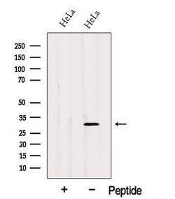 Invitrogen GSTO2 Polyclonal Antibody 100 &mu;L; Unconjugated:Antibodies,