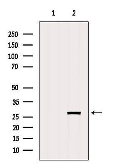 Invitrogen GSTO2 Polyclonal Antibody 100 &mu;L; Unconjugated:Antibodies,