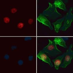 Invitrogen HELLS Polyclonal Antibody 100 &mu;L; Unconjugated:Antibodies,