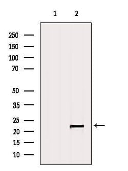 Invitrogen C11orf73 Polyclonal Antibody 100 &mu;L; Unconjugated:Antibodies,
