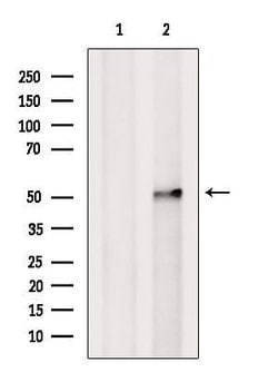 Invitrogen HMG20A Polyclonal Antibody 100 &mu;L; Unconjugated:Antibodies,
