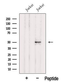 Invitrogen HMG20A Polyclonal Antibody 100 &mu;L; Unconjugated:Antibodies,