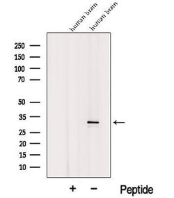 Invitrogen ICMT Polyclonal Antibody 100 &mu;L; Unconjugated:Antibodies,