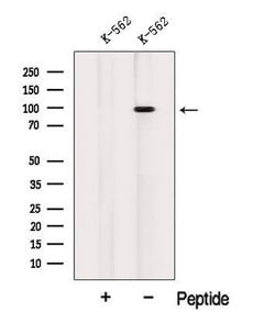 Invitrogen INVS Polyclonal Antibody 100 &mu;L | Buy Online | Invitrogen&trade; | Fisher Scientific