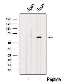 ISYNA1 Polyclonal Antibody:Antibodies, Polyclonal