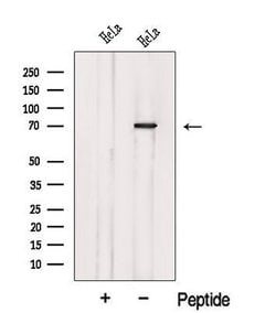 Invitrogen Katanin p80 Polyclonal Antibody 100 &mu;L; Unconjugated:Antibodies,
