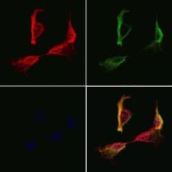 Invitrogen SSFA2 Polyclonal Antibody 100 &mu;L | Buy Online | Invitrogen&trade; | Fisher Scientific