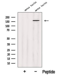 Invitrogen SSFA2 Polyclonal Antibody 100 &mu;L | Buy Online | Invitrogen&trade; | Fisher Scientific