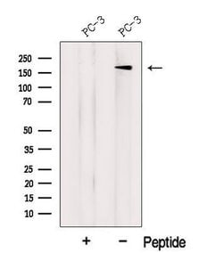 Invitrogen LTBP2 Polyclonal Antibody 100 &mu;L | Buy Online | Invitrogen&trade; | Fisher Scientific
