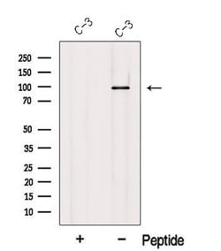 Invitrogen USHBP1 Polyclonal Antibody 100 &mu;L; Unconjugated:Antibodies,