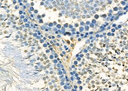 Invitrogen MED12 Polyclonal Antibody 100 &mu;L; Unconjugated:Antibodies,