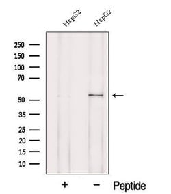 Invitrogen POMGNT1 Polyclonal Antibody 100 &mu;L; Unconjugated:Antibodies,
