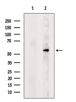 Invitrogen POMGNT1 Polyclonal Antibody 100 &mu;L; Unconjugated:Antibodies,
