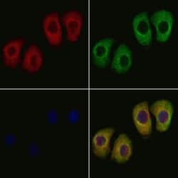 Invitrogen MMAB Polyclonal Antibody 100 &mu;L; Unconjugated:Antibodies,