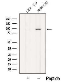 Invitrogen NELL1 Polyclonal Antibody 100 &mu;L; Unconjugated:Antibodies,