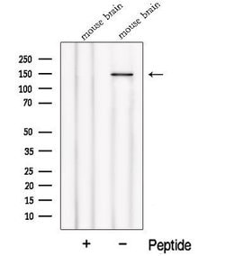Invitrogen NPHP4 Polyclonal Antibody 100 &mu;L | Buy Online | Invitrogen&trade; | Fisher Scientific