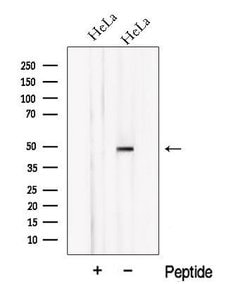 Invitrogen NXN Polyclonal Antibody 100 &mu;L | Buy Online | Invitrogen&trade; | Fisher Scientific