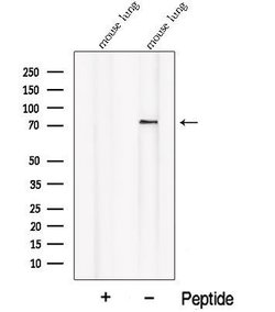 Invitrogen PALMD Polyclonal Antibody 100 &mu;L; Unconjugated:Antibodies,
