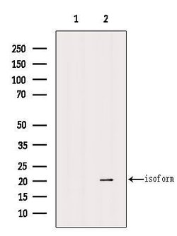Invitrogen PHD3 Polyclonal Antibody 100 &mu;L | Buy Online | Invitrogen&trade; | Fisher Scientific