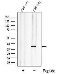 Invitrogen PHD3 Polyclonal Antibody 100 &mu;L | Buy Online | Invitrogen&trade; | Fisher Scientific