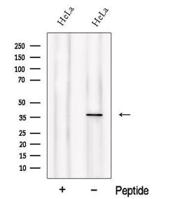 Invitrogen PIH1D1 Polyclonal Antibody 100 &mu;L; Unconjugated:Antibodies,