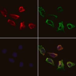 Invitrogen PPP3CB Polyclonal Antibody 100 &mu;L; Unconjugated:Antibodies,