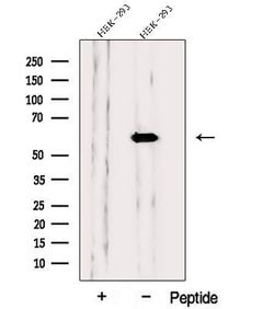 Invitrogen PPP3CB Polyclonal Antibody 100 &mu;L; Unconjugated:Antibodies,