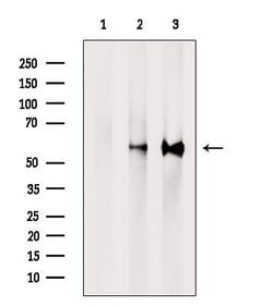 Invitrogen PPP3CB Polyclonal Antibody 100 &mu;L; Unconjugated:Antibodies,