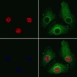 Invitrogen PRPF4 Polyclonal Antibody 100 &mu;L; Unconjugated:Antibodies,