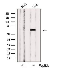Invitrogen PRPF4 Polyclonal Antibody 100 &mu;L; Unconjugated:Antibodies,